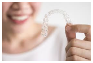 Invisalign Aligners Treatment